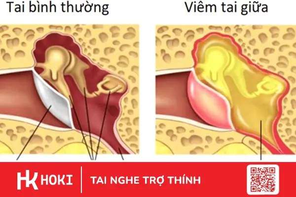 tre-viem-tai-giua-nguy-co-suy-giam-thinh-luc-can-canh-giac-1